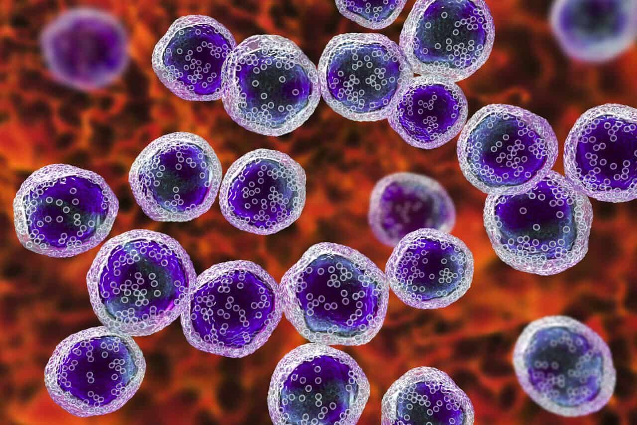 Photo 128276917 | Cancer Cells © Kateryna Kon | Dreamstime.com